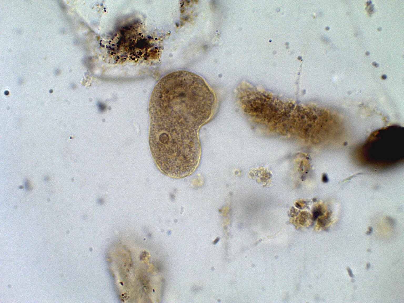 Entamoeba Histolytica Trophozoite Parasitology