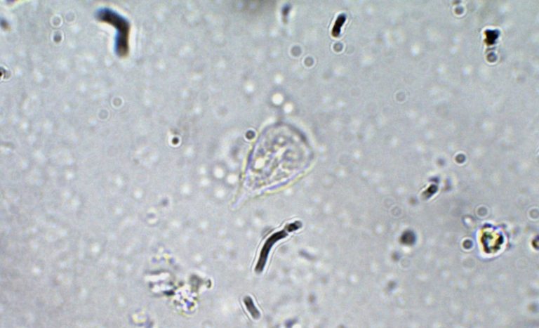 Giardia Lamblia Trophozoite Parasitology