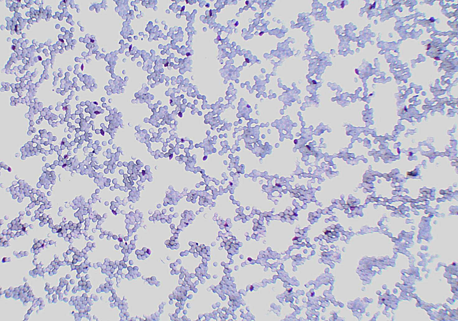 Plasmodium Falciparum Gametocyte Parasitology