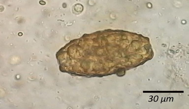 Ascaris Lumbricoides Unfertilized Egg