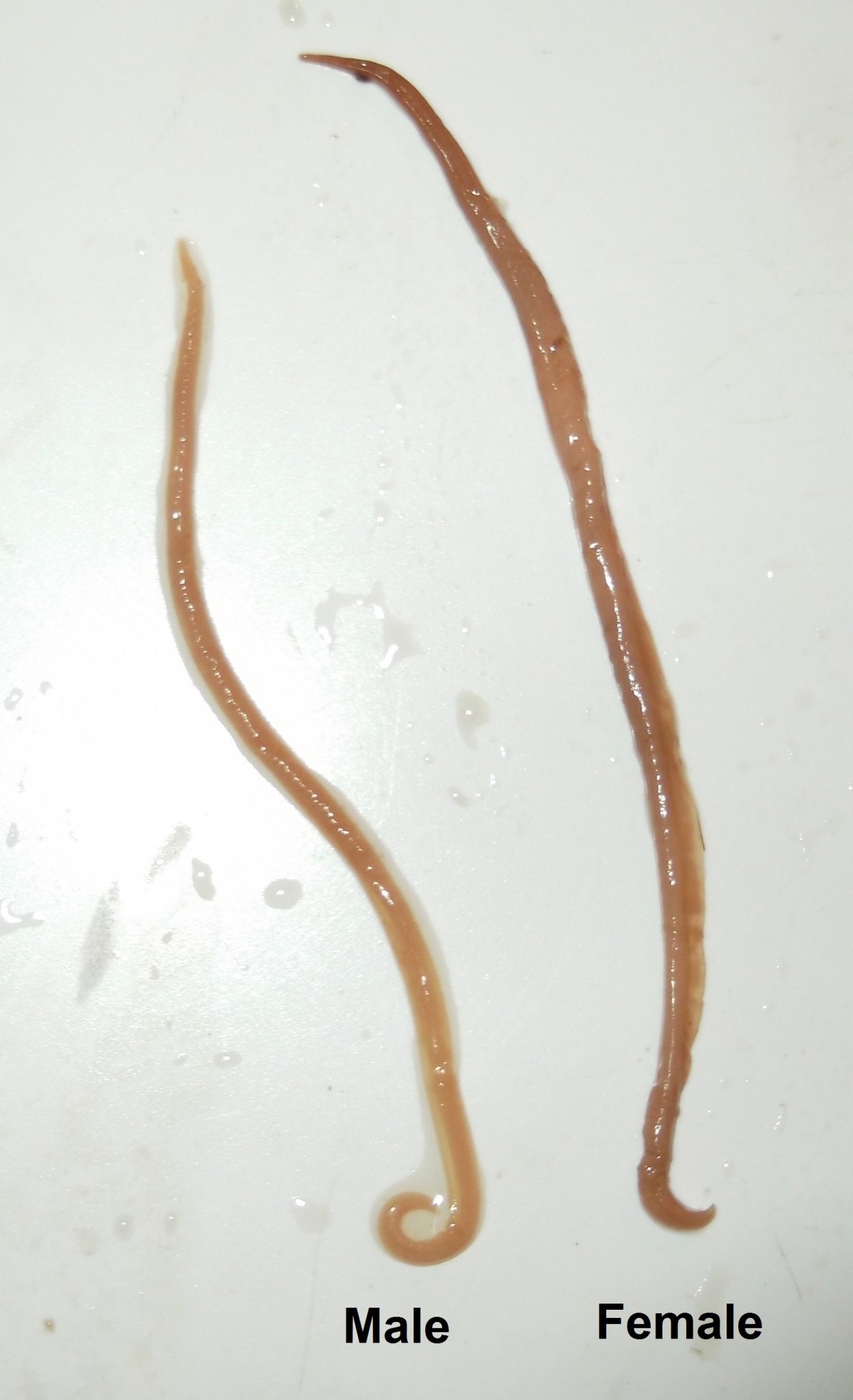 Ascaris lumbricoides (Large Roundworm) – Adult – Parasitology