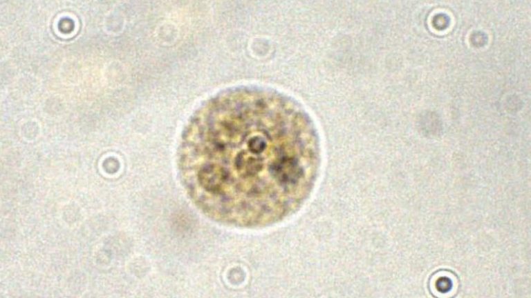 Entamoeba Histolytica Cyst Parasitology 7108