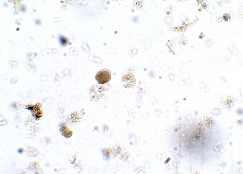 Entamoeba Histolytica Cyst Parasitology