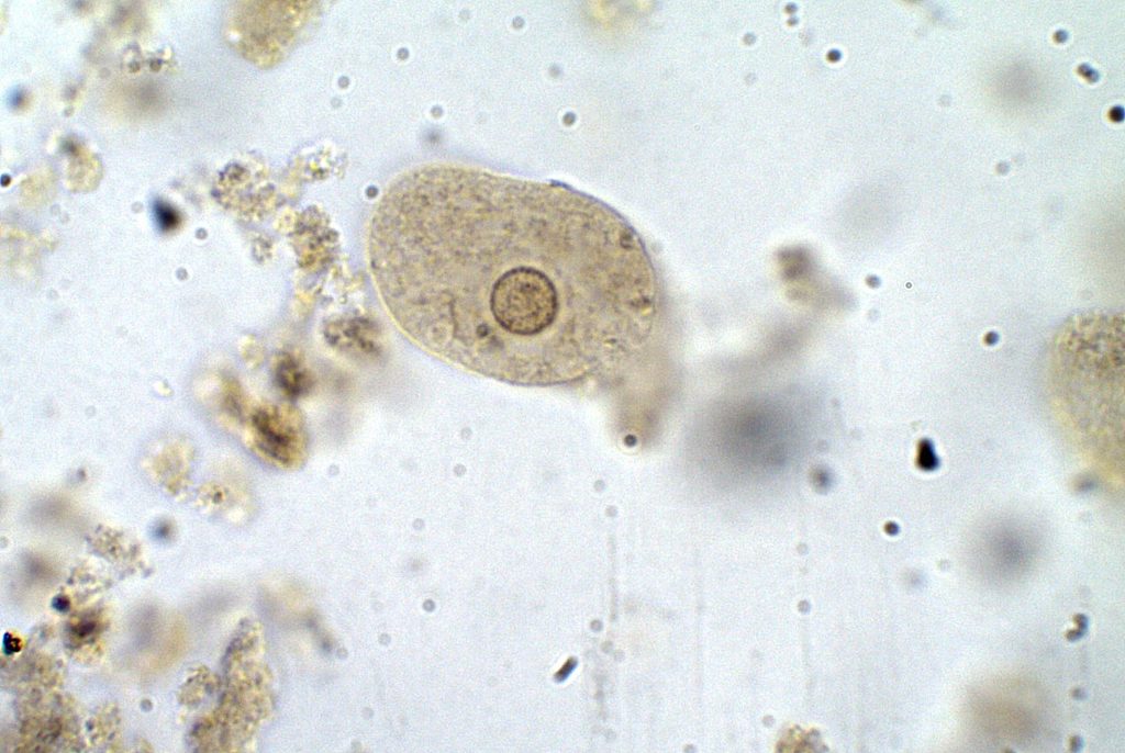 Entamoeba coli – Trophozoite – Parasitology