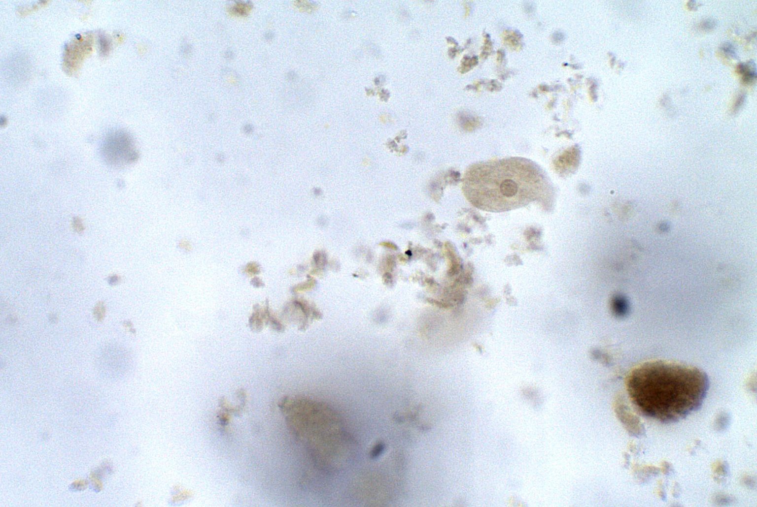 Entamoeba Coli Trophozoite Parasitology 6981