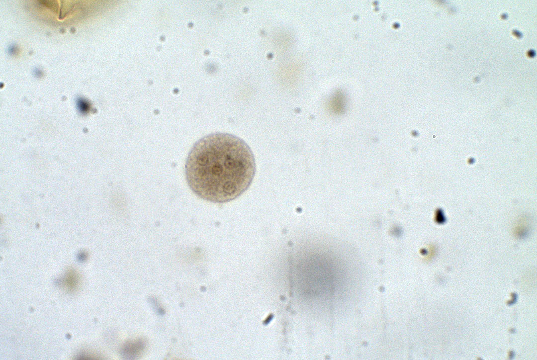 Entamoeba coli в кале