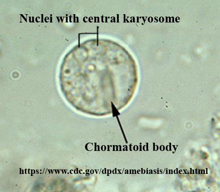 Entamoeba Histolytica Cyst Labeled