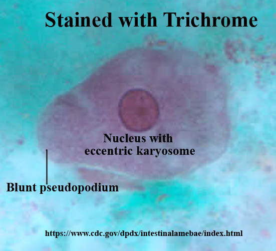 Entamoeba coli – Trophozoite – Parasitology