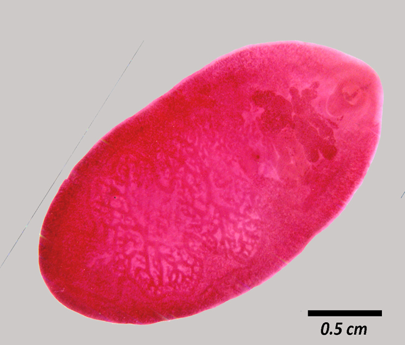 fasciolopsis-buski-fasciola-hepatica-method-of-diagnosis-eggs-in