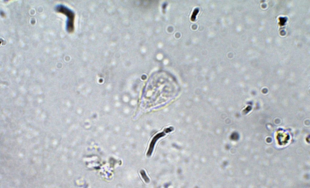 Giardia Lamblia Trophozoite Parasitology 5234