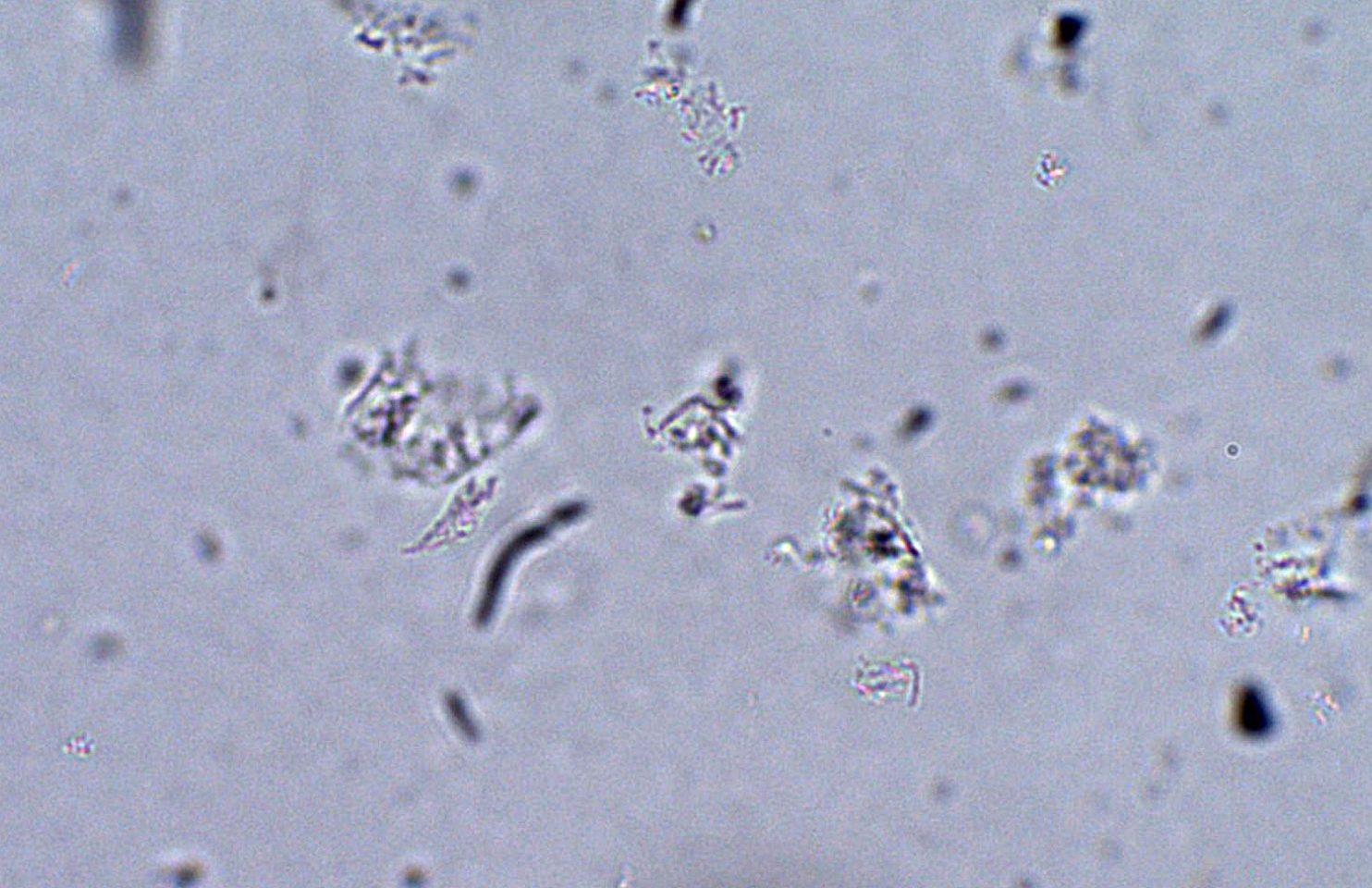 Giardia lamblia – Trophozoite – Parasitology