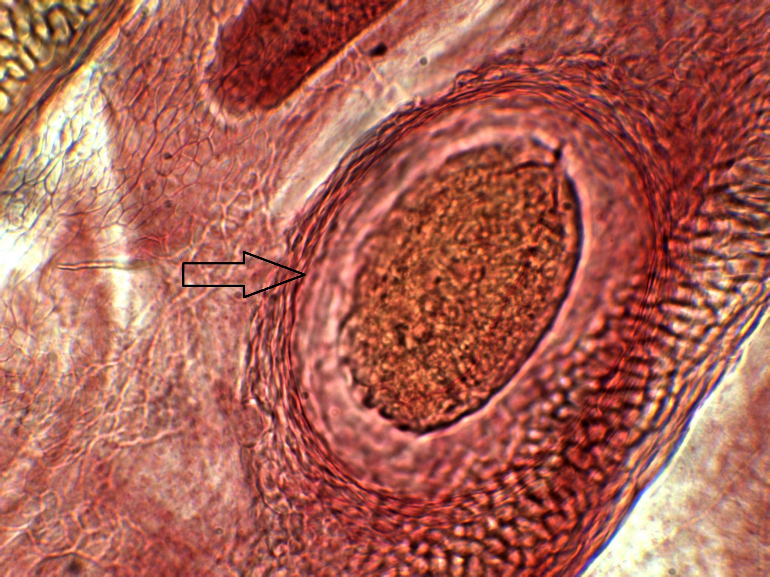 Metacercaria Stage – Parasitology