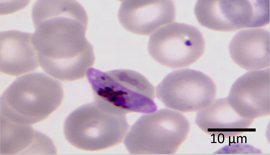 Plasmodium falciparum – Gametocyte – Parasitology