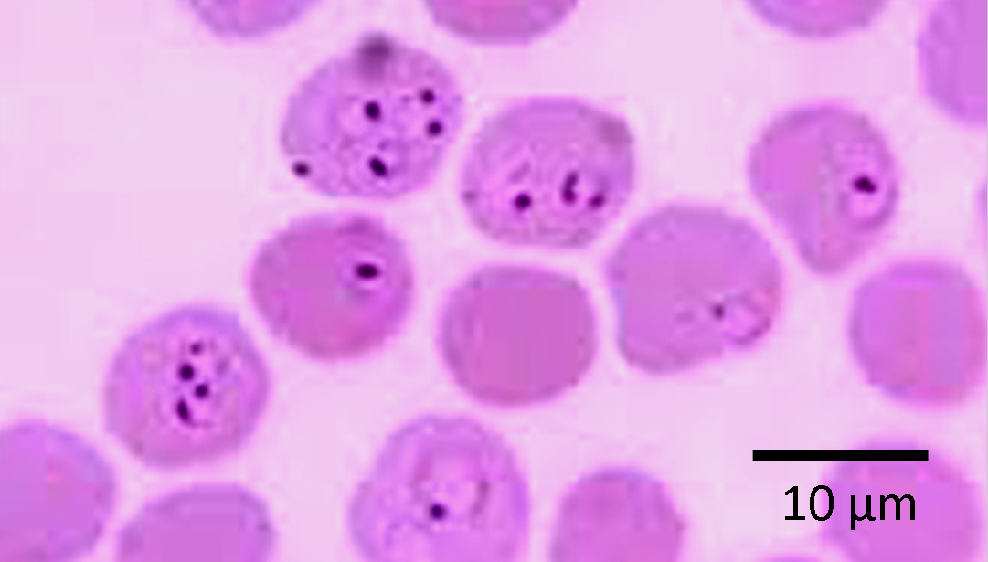 Plasmodium Falciparum Rings Parasitology 3785