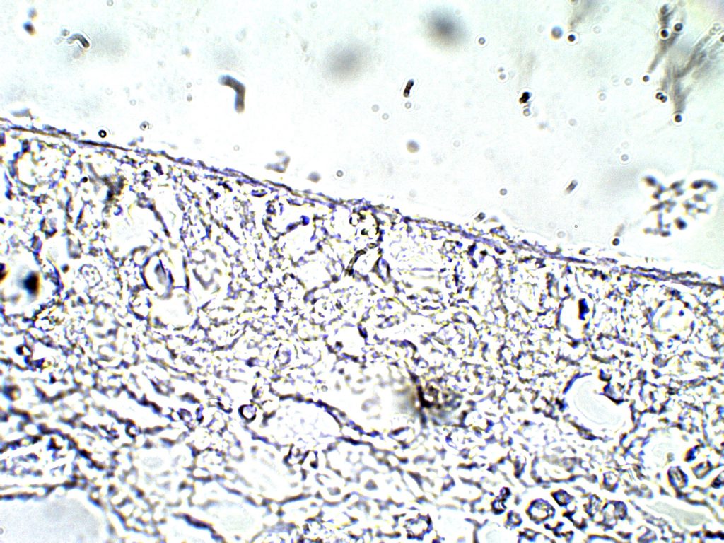 Tegument of Cestodes – Parasitology