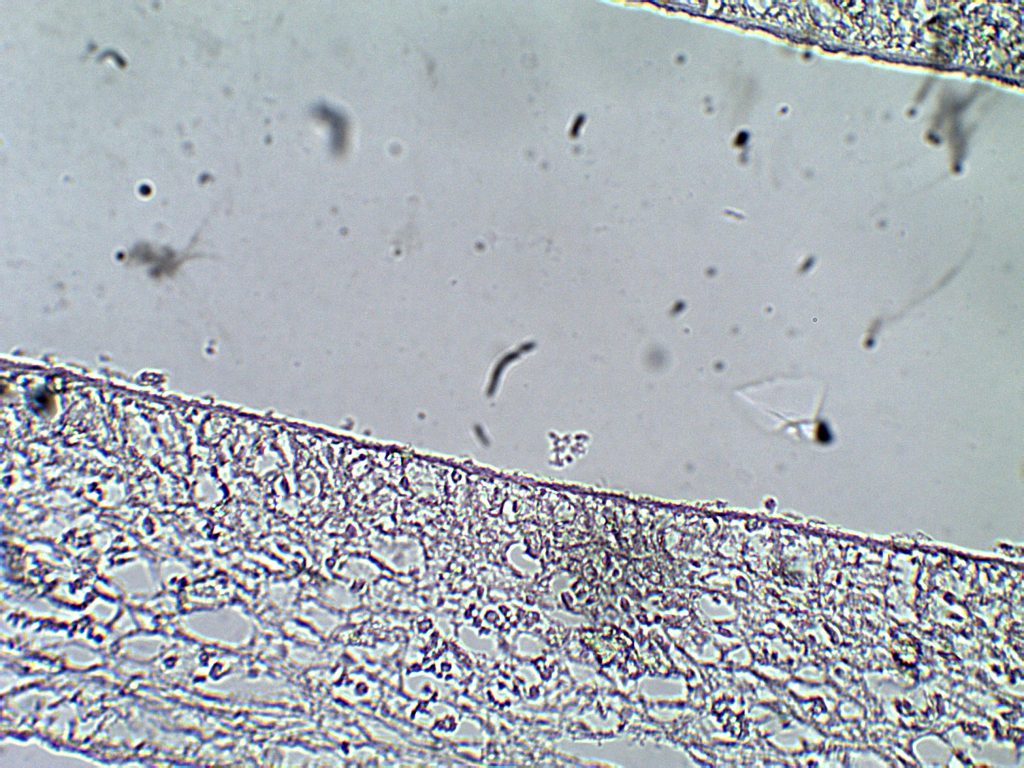 Tegument of Cestodes – Parasitology