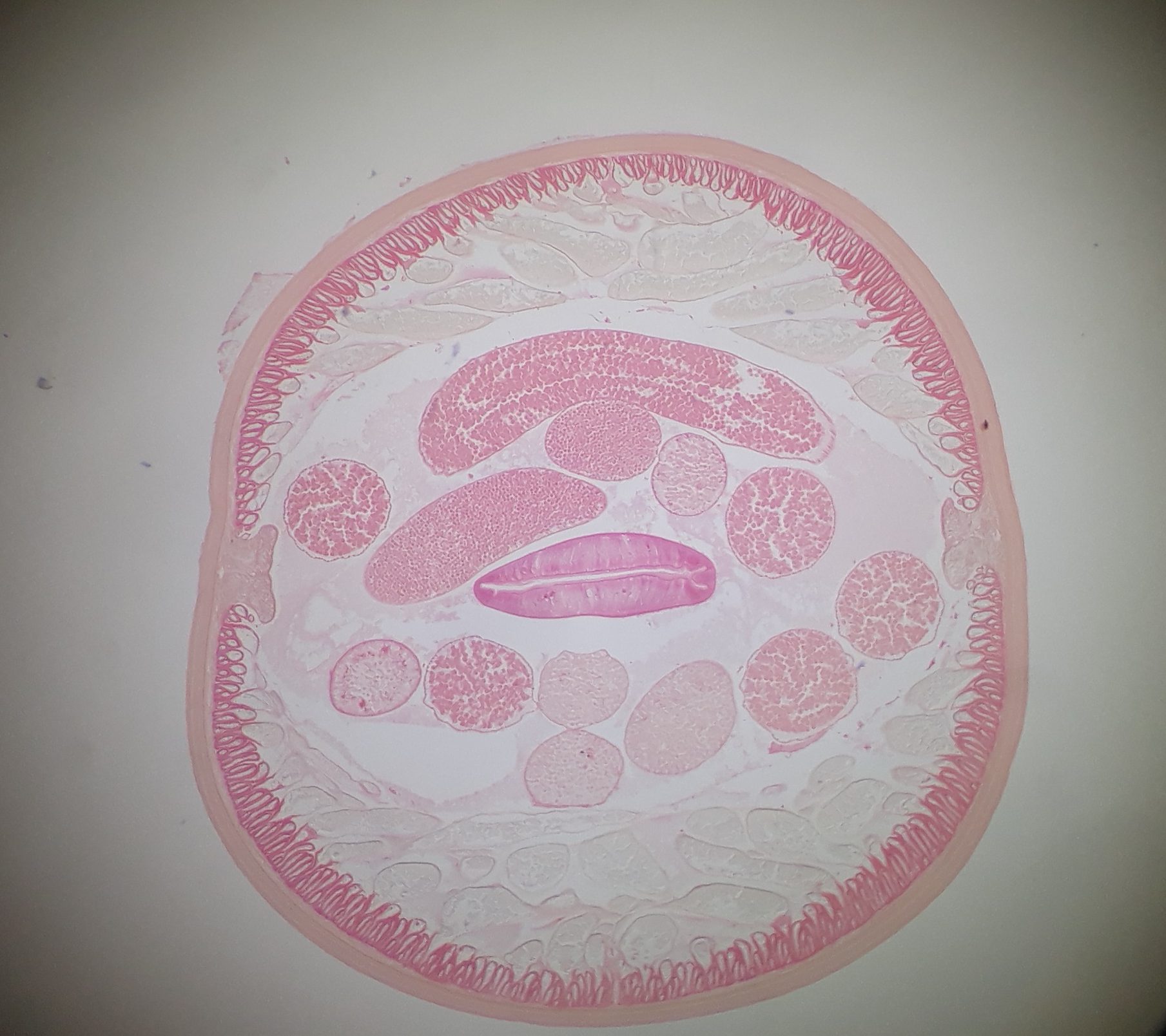 Ascaris Lumbricoides Structure