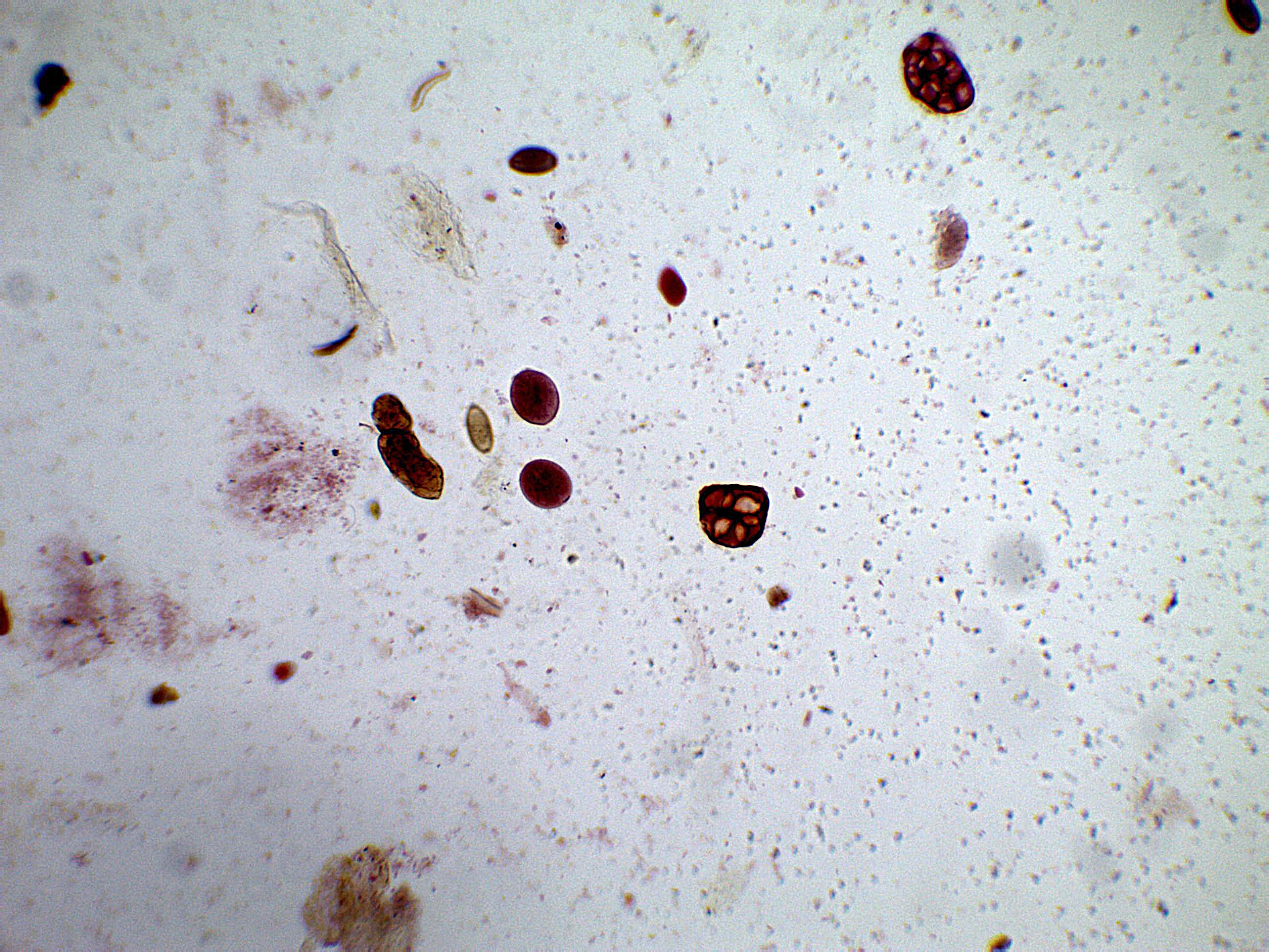 Balantidium Coli Cyst Parasitology 2550