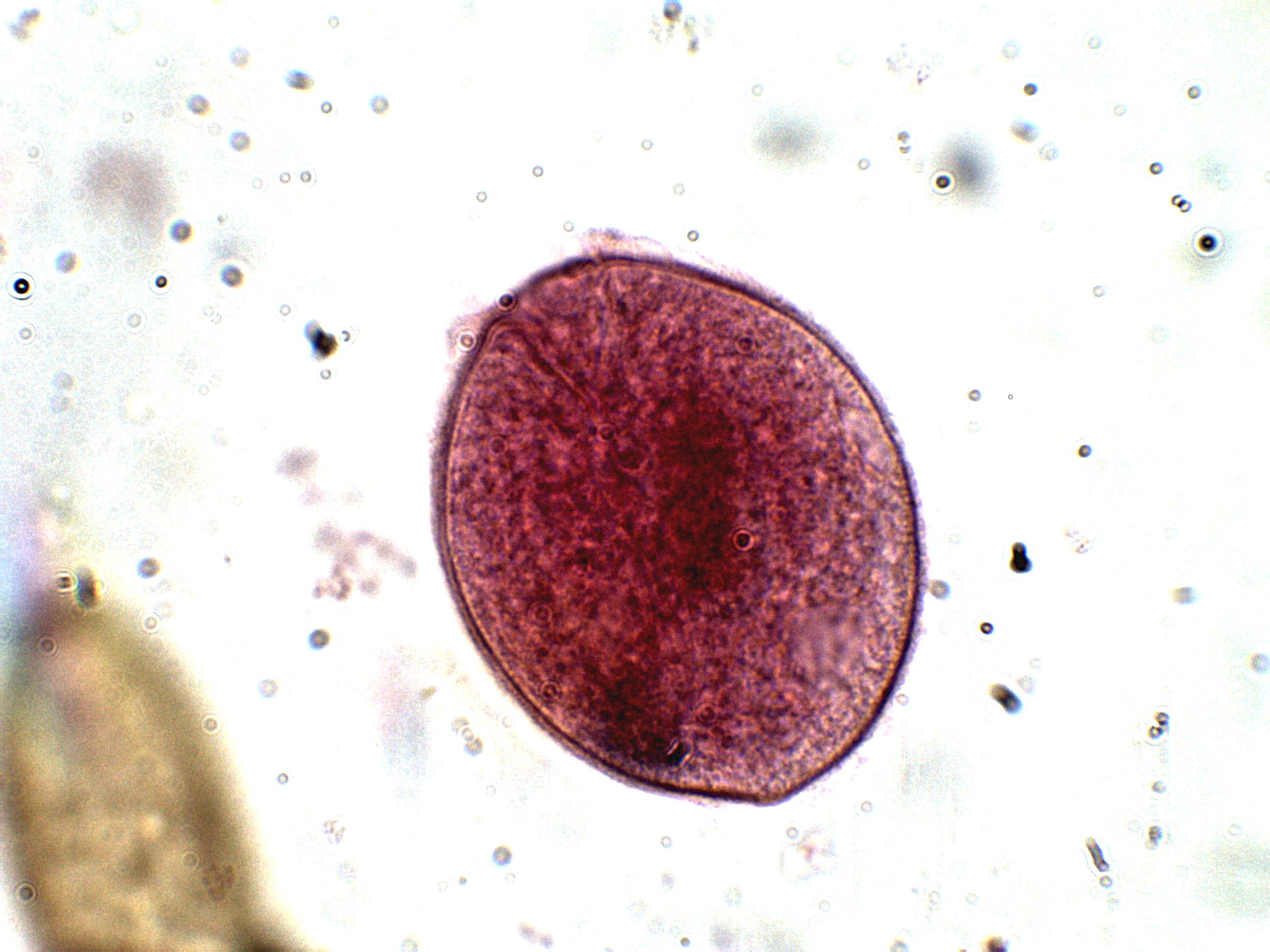 Balantidium Coli Cyst Form