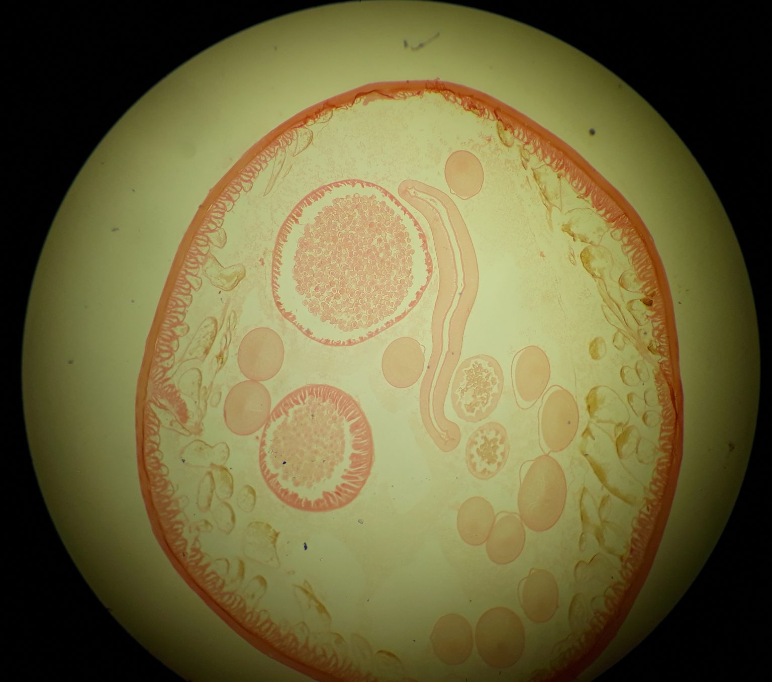 Ascaris Lumbricoides Female Cross Section Parasitology 6590