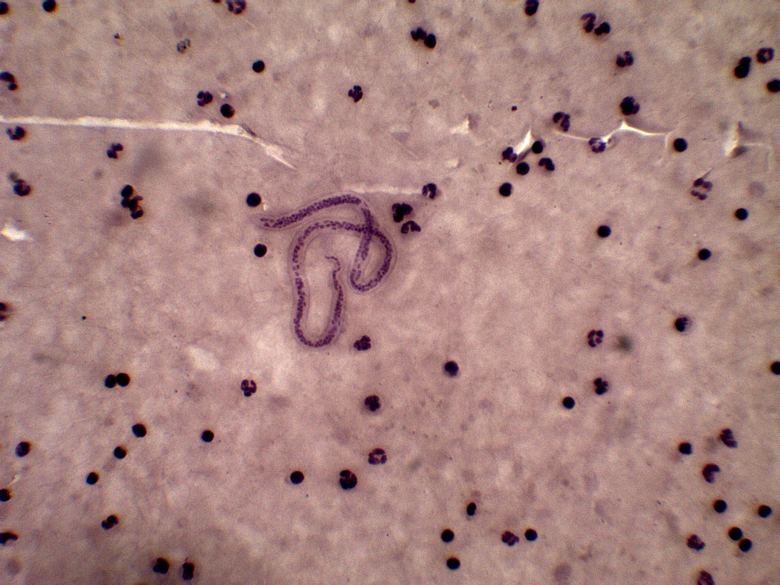 Wuchereria Bancrofti – Parasitology