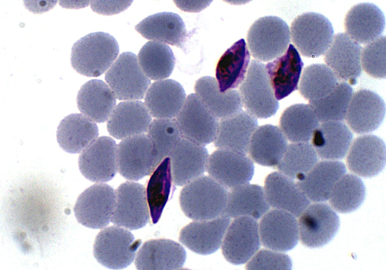 Plasmodium Falciparum Gametocyte Parasitology 9172