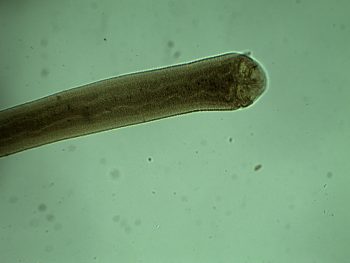 Hymenolepis diminuta (Rat Tapeworm) – Parasitology