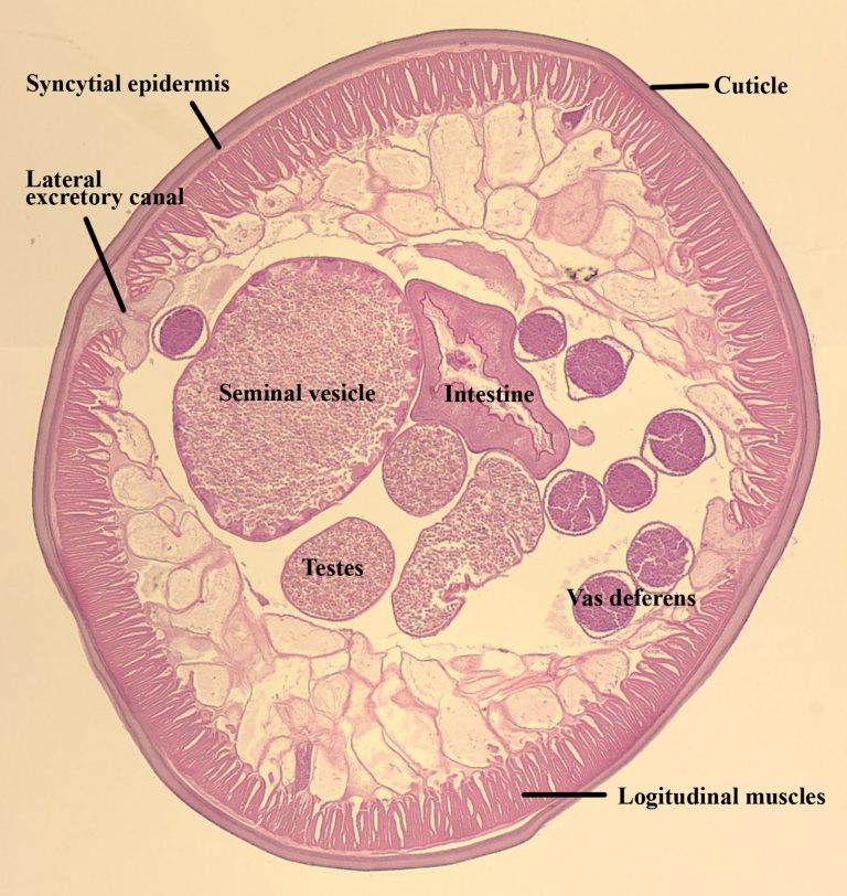 Ascaris lumbricoides – Male Cross Section – Parasitology